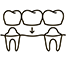 Dental Bridge or Denture