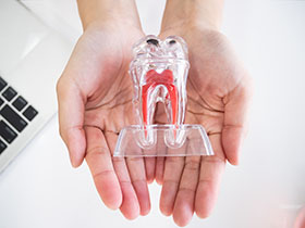 RCT for Tooth Infection