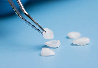 Why Porcelain Veneers